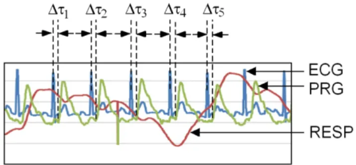Fig. 7. (Color online) The analysis of PWV from clinical 40 participants. The average value of PWV is about 6 m/s.