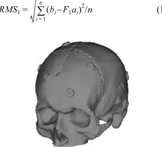 Fig. 8 Finding marker center Fig. 9 Triangular surface model for a phantom skull