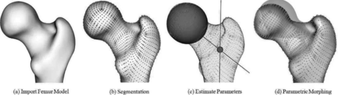 Fig. 1. A pipeline of the proposed parametric morphing method: (a) Import of the femur model as a NURBS patch surface, (b) Automatic segmentation of the morphology into interesting regions (c) estimation of femoral parameters by least square method and def