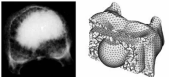 Fig. 2.  Virtual endoscopy [14] .