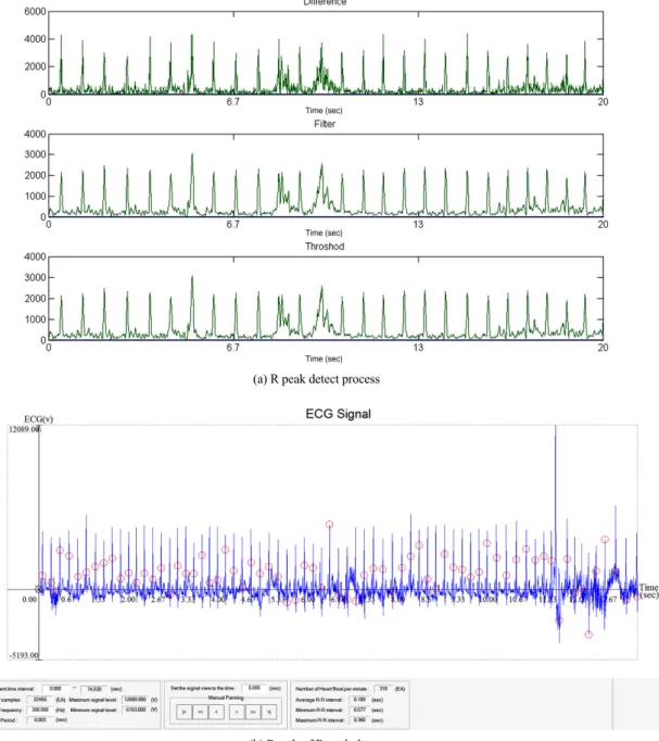 Table 1에는  ECG 검출  알고리즘의  성능을  검증하 기  위해서  Sensitivity와  positive predictivity 값들을  R  peak  검출  성능으로  간주하였으며  아래  식들  (7)과  (8)은  아래와  같다