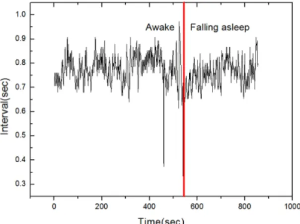 Fig. 7 An example of an experiments of R-R interval with  awake and drowsiness events