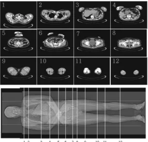 Fig. 4 Volunteer in sitting posture (left) and X-ray images  (middle, right) 4.4  살  두께  측정을  위한  초음파  탐상 앉은  자세로  재구성된  골격형상을  3차원  표피  스 캔  모델에  정밀하게  위치시키기  위하여  Fig