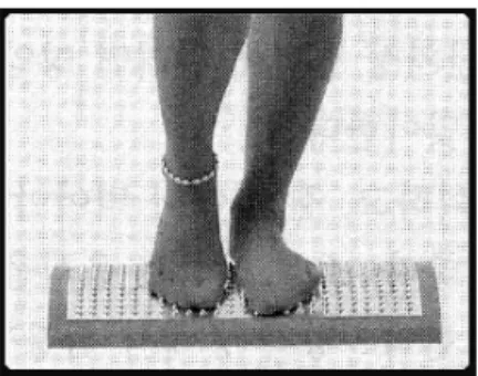 Fig. 2. Korean dry cupping region.               Fig.  3. Stepping on ion aluminum board.