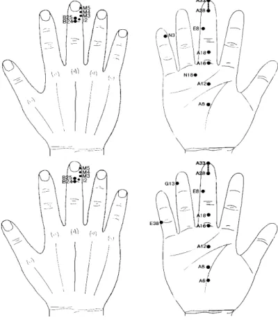 Fig. 1. Applied Hand Acupuncture site  (upper: male, lower: female)