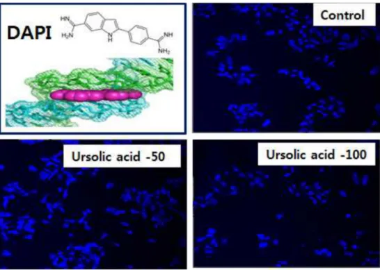 Fig. 4. Morphological change of ursolic acid in AGS cells.