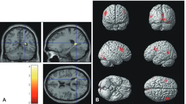 Fig. 3. Significantly activated brain regions of within-group analysis  in adult group