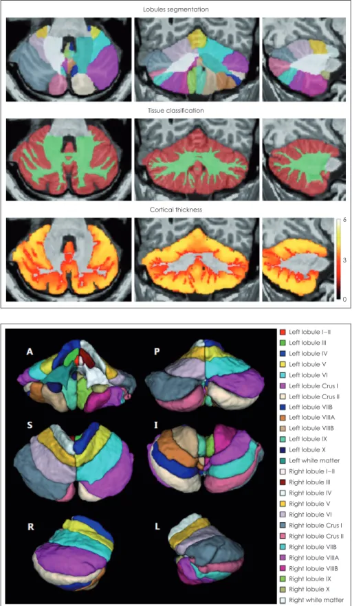Fig. 1. Automated cerebellum lob- lob-ule segmentation by CEREbellum  Segmentation (CERES)