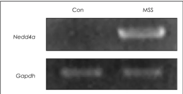 Fig. 2. Confirmation of cDNA microarray results of Ned- Ned-d4a by RT-PCR. As an internal control,  glyceral-dehydes-3-phosphate dehydrogenase(Gapdh)  was amplified