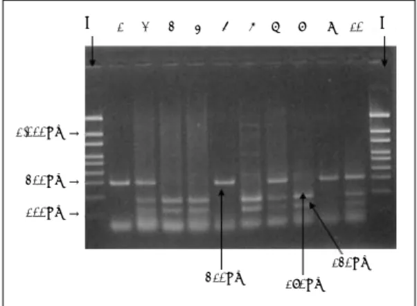 Fig. 1. PCR analysis of Taq  I  polymorphism  in  DRD 2
