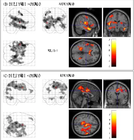 Fig. 2. The SPM results of the group comparison between schizophrenia group and matched healthy control group are shown on the glass window