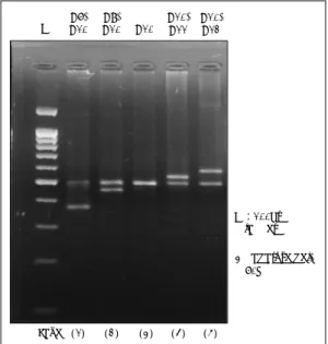 Fig. 1. Separation of PCR-amplified allelic variants at the DAT1 VNTR locus by agarose gel electrophoresis and ethidium bromide staining