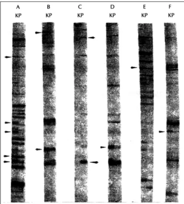Fig. 1. Differentially expressed mRNAs between in PC12 cells and A123.7 cells. The total RNAs were purified from A123.7 cell and PC12 cell