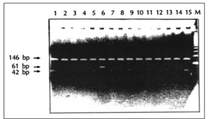 Fig. 1. PCR analysis of Dde I Restriction fragment length polymorp- polymorp-hisms in Dopamine D 1  receptor alleles for schizophrenic  pa-tients