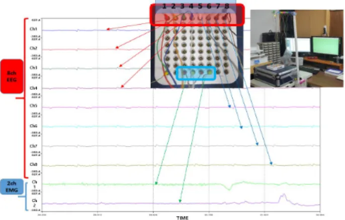 Fig. 1. EEG and EMG measurement system and electrode.