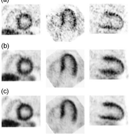 Fig. 1.5 (a) Sample images from one of the six respiratory-gated frames and from selected sample (Left) short-axis, (Middle) horizontal long-axis, and (Right) vertical long-axis slice images obtained using a 3D OS-EM image reconstruction without any motion