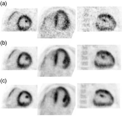 Fig. 1.6 (a) Sample images from one of the six respiratory-gated frames and from selected sample (Left) short-axis, (Middle) horizontal long-axis, and (Right) vertical long-axis slice images obtained using a 3D OS-EM image reconstruction without any motion
