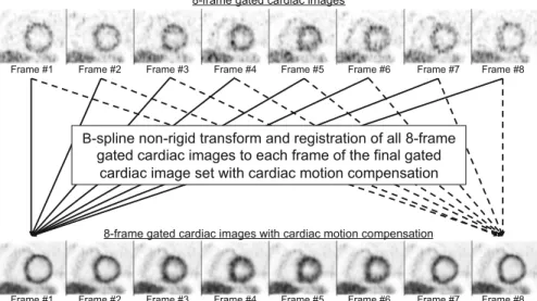 Fig. 1.3 In the CM compensation, a B-spline non-rigid transformation and registration was applied to each cardiac-gated image and registered it to the reference frame and summed