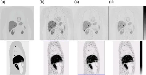 Fig. 1.4 Results from a simulation study to evaluate the 4D PET image reconstruction with respiratory and attenuation compensation for improved lung lesion detection