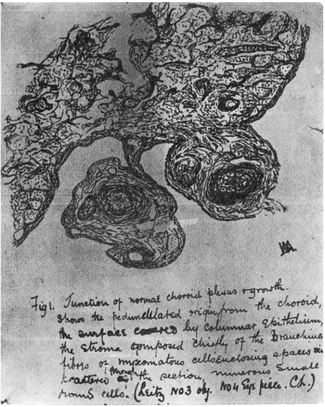 Fig. 1 Sketch of the choroid plexus by one of the West Riding’s staff in 1901.