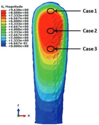 Figure 13. Displacement contours of the rostrum subjected to uniform pressure loading with a ﬁxed plate boundary condition showing the location of source/sink