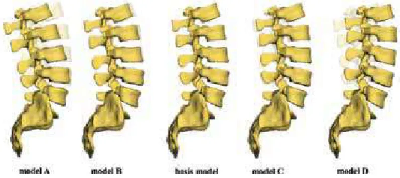Figure 4. MBS lumbar spine models with different alignments: The model located in the middle has to be understood as a basic model concerning the anthropometrical and biomechanical properties for the further models A, B, C, and D.
