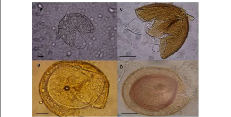 FIGURE 1 | Spores of arbuscular mycorrhizal fungi used in this study. (A) Acaulospora colombiana and (C) Ambispora appendicula stained with lactoglycerol polyvinyl