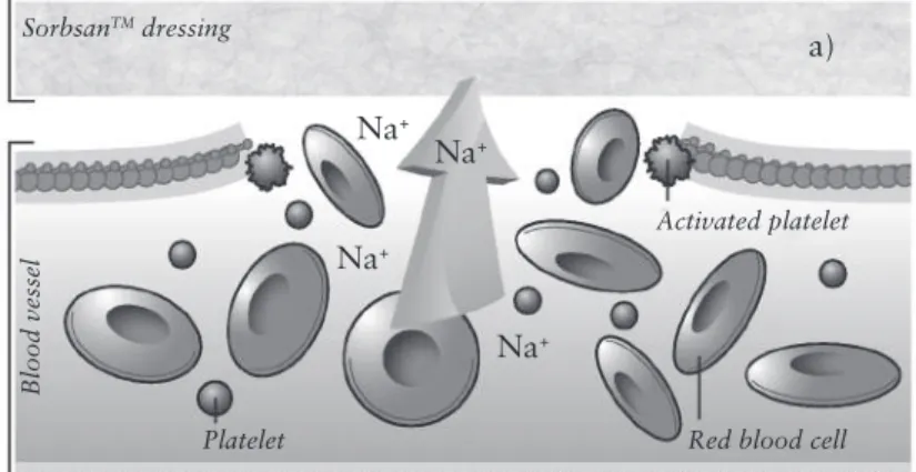 Figure 8.3 The Na +  ions present in wound fluids and around damaged tissues are  absorbed a) and exchanged for Ca 2+  ions in the alginate dressing, and  b) Ca 2+  ions then support the coagulation cascade
