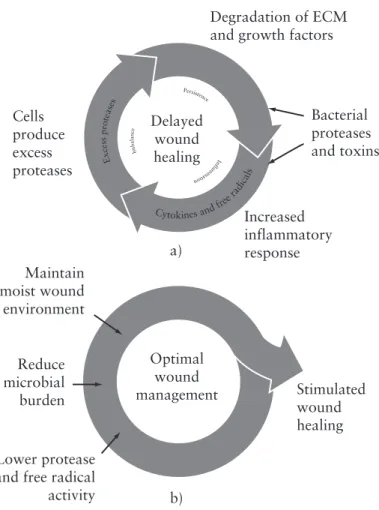 Figure 6.3 Cullen’s circle, a) the vicious circle of delayed wound healing and  b) breaking out of the circle to encourage healing