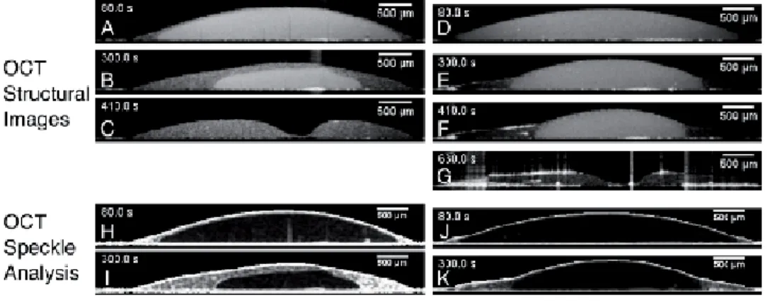 Figure 3 showed time-lapse OCT imaging of drying L and S latex droplets. In  Figure 3A and B, a domain boundary was clearly observed inside the L latex droplet  with distinct scattering properties