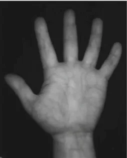 Fig. 5.1 Palm vein image captured by experiment device