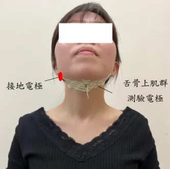 圖   3-3-4 測驗舌骨上肌群之貼片位置示意圖