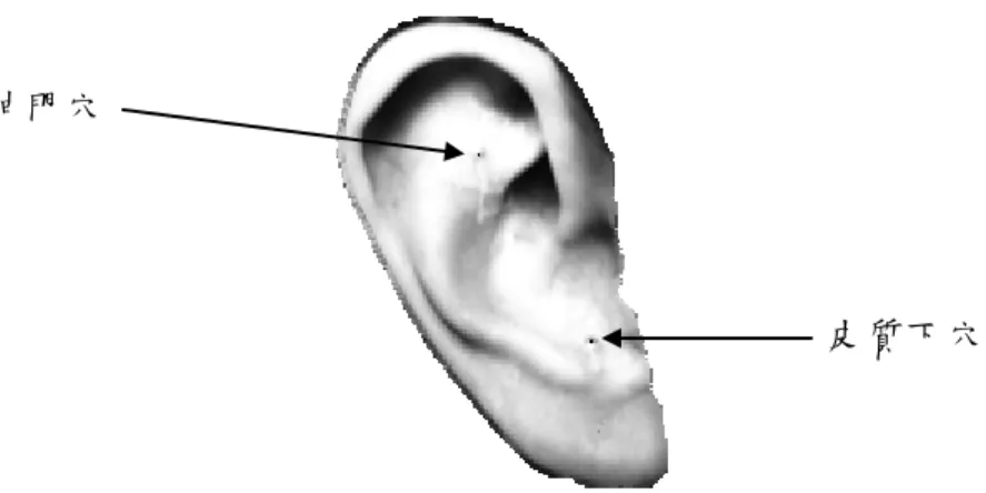 圖 3-3  耳穴貼壓方案之取穴部位 