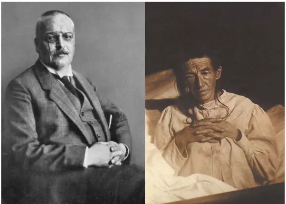 Figure 2.1.  Dr. Alois Alzheimer (left) and his patient, Auguste Deter (right). 