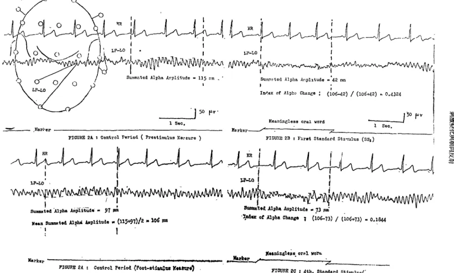 FIGURE 2B : F1rat Standard St1叮"Ius (8SI )i50flv'