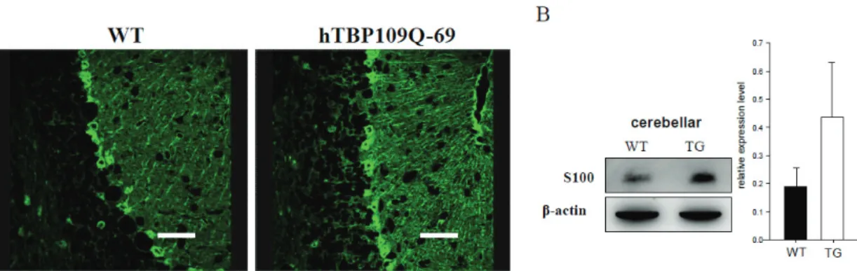 Figure 2. Upregulation of S100 in SCA17 transgenic mice. (A) Immunofluorescence analysis of S100 expression in  wild type (5 months old) and line 69 (5 months old) transgenic mouse cerebella