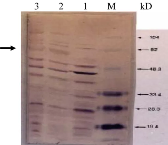 Figure 2. Immunoblotting assay for the identification of  SAG1. After sodium dodecyl sulfate-polyacrylamide gel  electrophoresis, soluble T