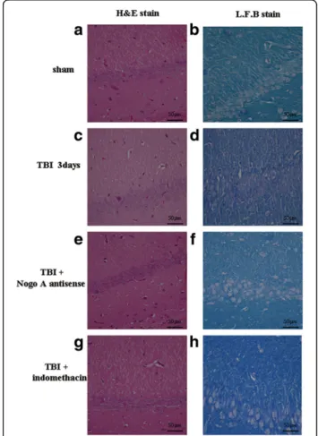 Figure 5 Effects of indomethacin and Nogo-A antisense administration on brain edema following traumatic brain injury (TBI)