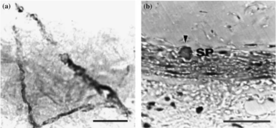 Figure 1. Immunohistochemical localization of GABAergic neurons in the rat stomach. GAD positive processes in the muscle layers (a) and submucosal layers (b)
