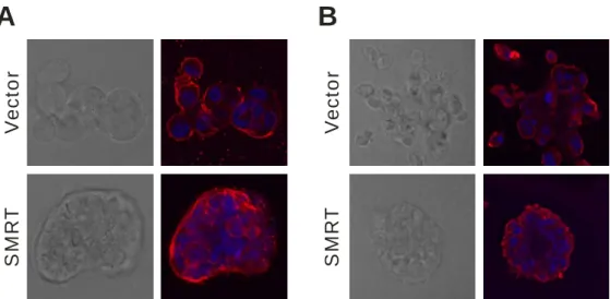 Figure 5    Overexpression of SMRT results in partial reestablishment of tissue organization
