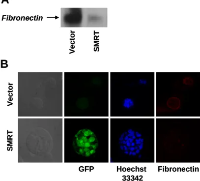 Figure 2    SMRT downregulates the protein expression of fibronectin in neoplastic MECs