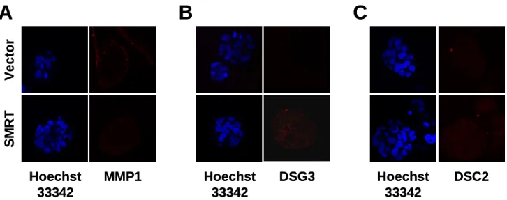 Figure 3    SMRT downregulates the expression of MMP1 while upregulates the expression of  desmosomal cadherins