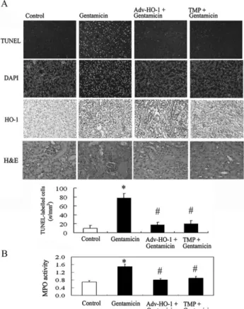 Fig. 4. Haem oxygenase (HO)-1 responsible for the protective effects of tetramethylpyrazine (TMP) against gentamicin-induced free radical production in NRK-52E cells