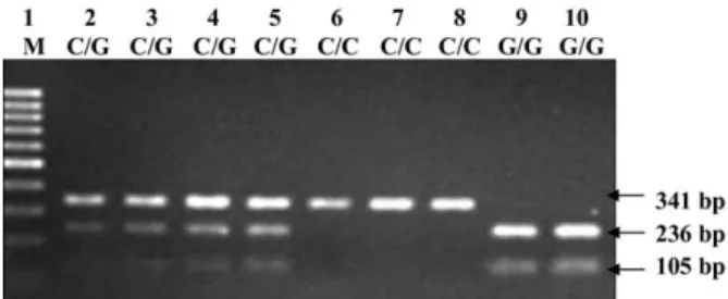 Figure 1. Polymerase chain reaction-restriction fragment length polymorphism analysis to detect ⫺31 C/G  polymor-phism of survivin promoter