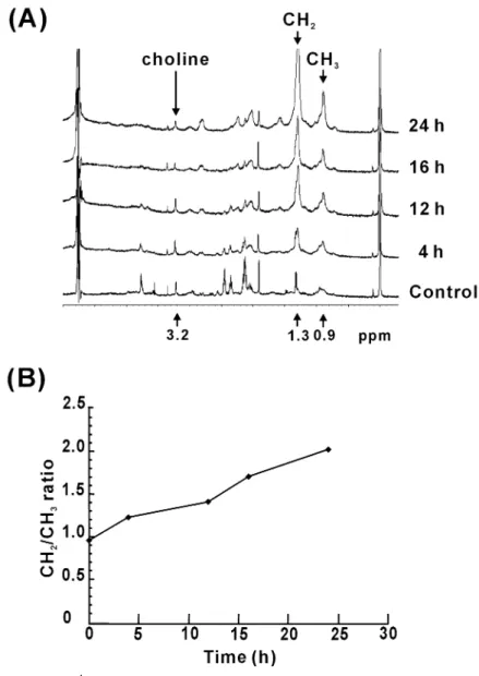 FIGURE 2. 1 H NMR spectra of Cd-treated MRC-5 cells. (A) MRC-5 cells were treated with 100  µM CdCl 2  for the indicated time periods and resuspended in 90% D 2 O/PBS before measurement of  1 H NMR spectra obtained at 500 MHz