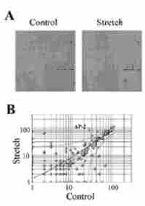 Figure 1. cDNA microarray analysis of mechanical stretch-induced gene expression in neonatal rat cardiomyocytes