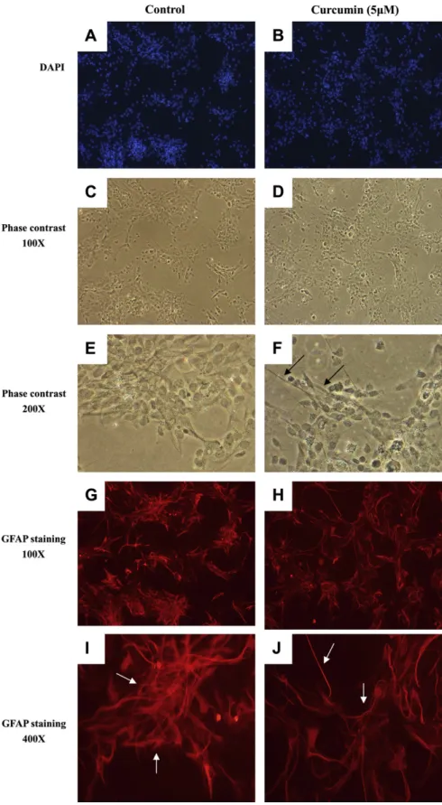 FIG. 6. Inhibitory effects of curcumin treatment on astrocyte morphology and GFAP immunofluorescent staining