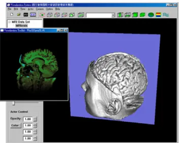 Figure 11. The interactive three dimensional  browsing feature for medical data set.  