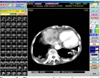 Figure 7. The system displays the examined  images which are then compared with the  appropriate medical images