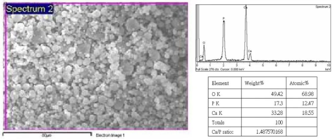 Figure 4 EDS analysis of ACP (amorphous calcium phosphate) 